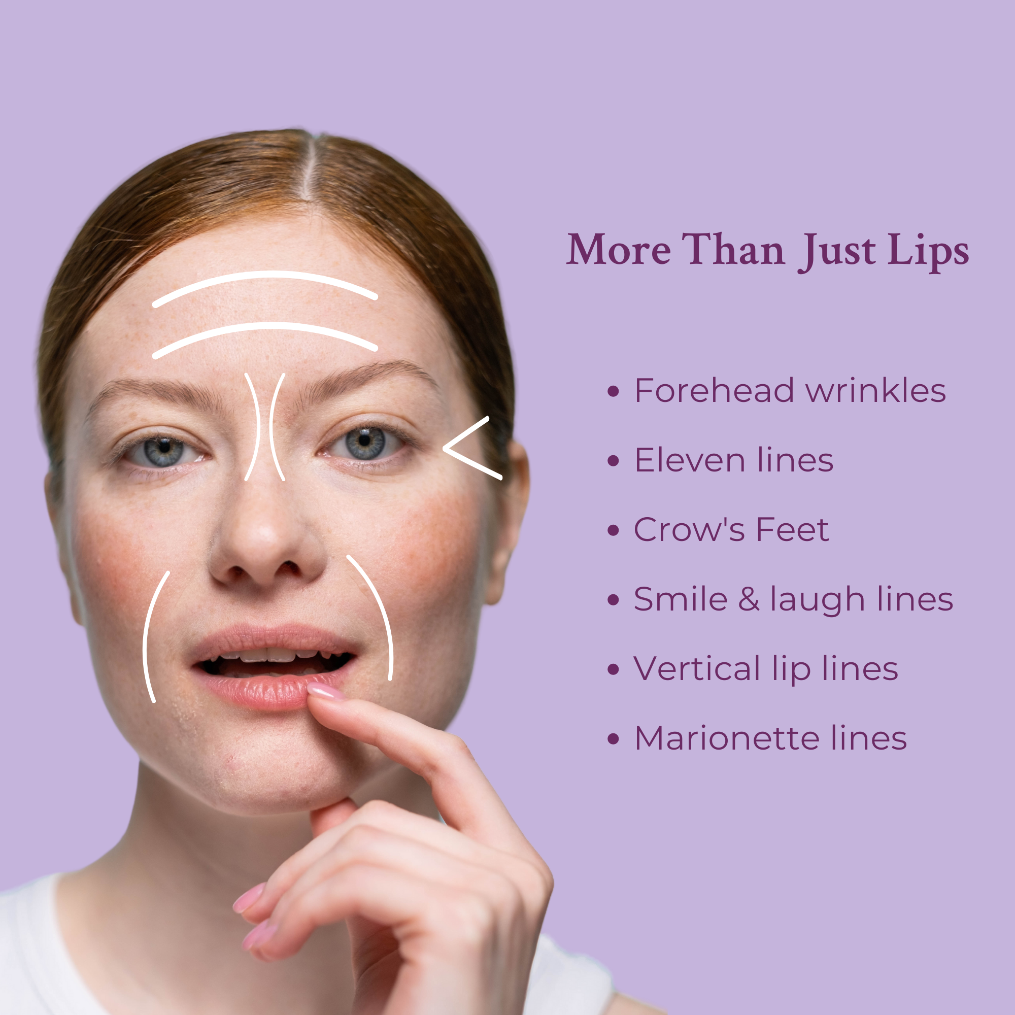 Ageless Lip & Line Filler 8mL